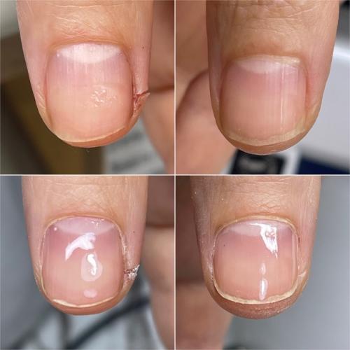 Рекомендуемое время между гигиеническими обработками ногтей на руках без покрытия - 10-14 дней. 01