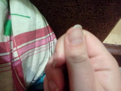 Девочки всем доброго вечера, кто с таким сталкивался? 01