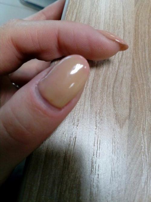 Девочки, подскажите плиз, почему глак меняет цвет (желтеет? 01