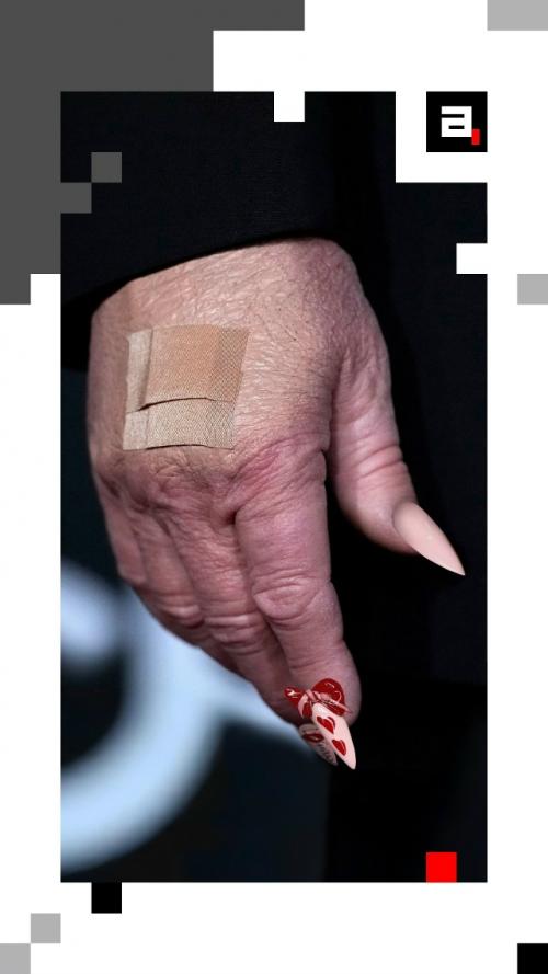 Трамп в тренде: американский лидер примерил модный маникюр. 02