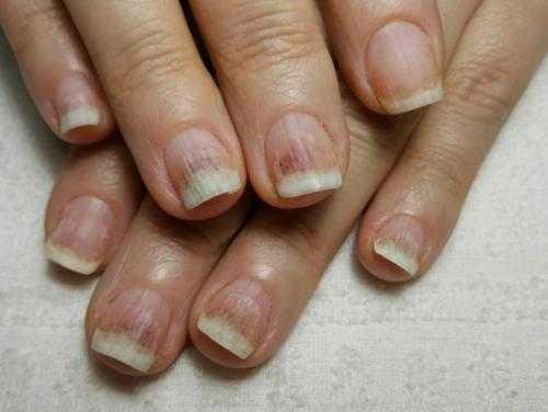 Здравствуйте!  Пожалуйста анонимно. 01