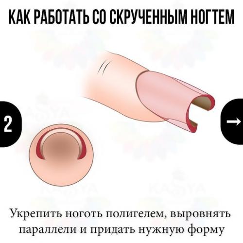 Как работать со скрученным ногтем? 01