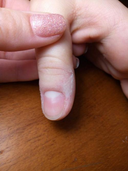 Здравствуйте.  Девочки, подскажите что это может быть? 01