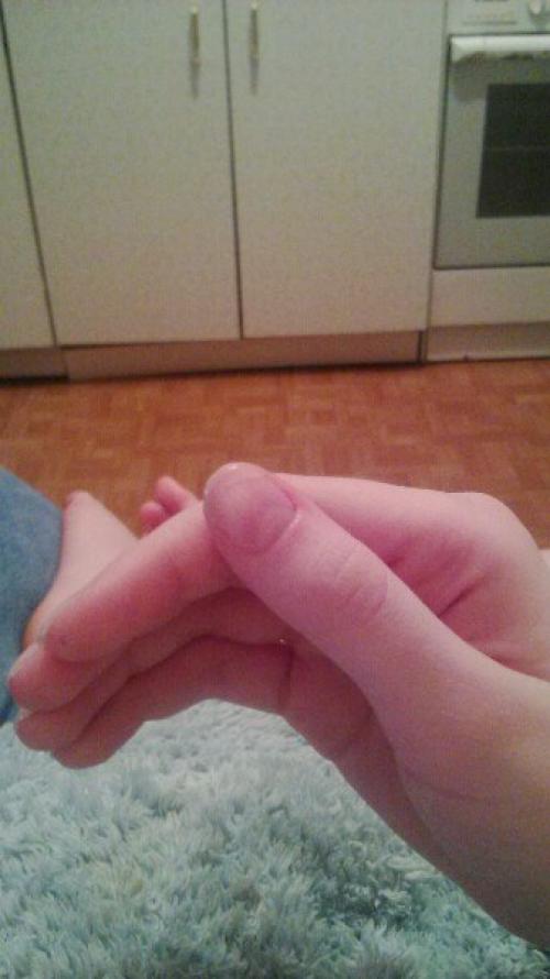 Можно анонимно, пожалуйста девочки, подскажите пожалуйста, что такое может быть. 01