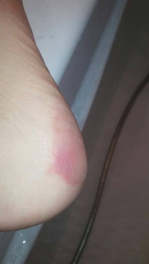 Анонимно пожалуйста!  Подскажите что со ступнями, пятками, пальцами? 03