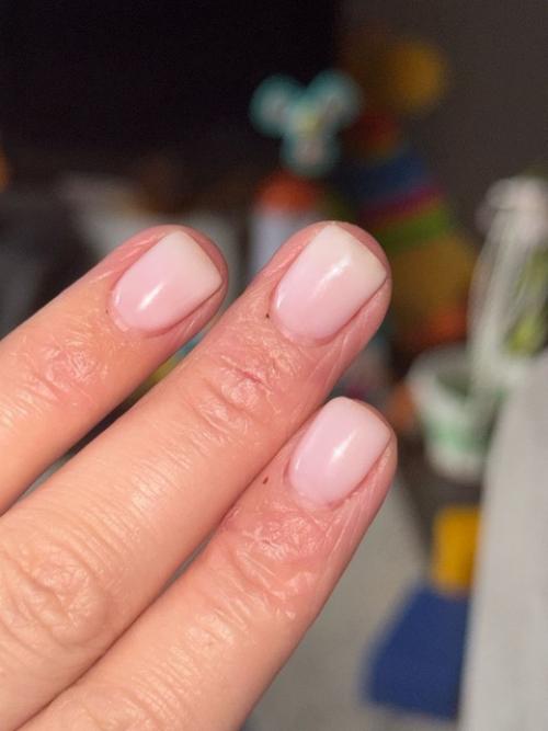 Почти аллерголог. Как многие знают, я много лет занимаюсь лечением детей с ДЦП. 01 Почти аллерголог. Как многие знают, я много лет занимаюсь лечением детей с ДЦП. 01