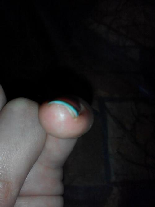 Добрый день!  Девочки, уже писала, что у девочек начал отслаиваться г. лак, думала в чем дело. 01