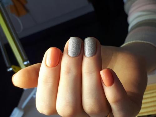 Плазмонный сенсор позволяет диагностировать рак на ранних стадиях. 02 Плазмонный сенсор позволяет диагностировать рак на ранних стадиях. 02