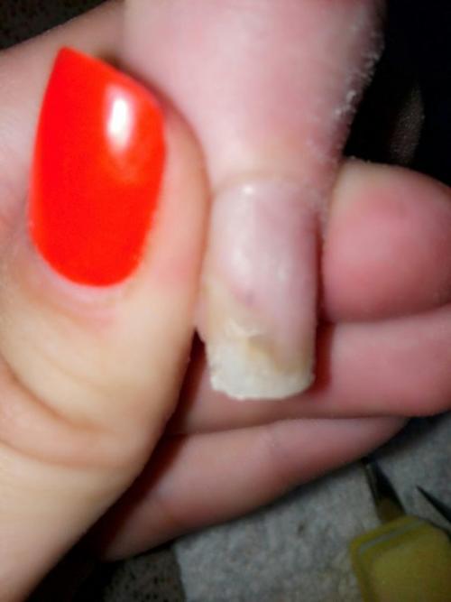 Здравствуйте девочки.  Ко мне сегодня пришла клиентская с такими ногтями. 02