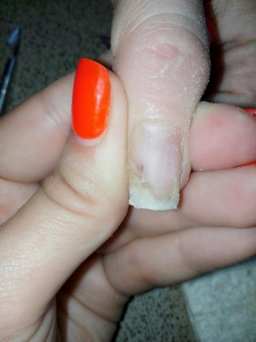 Здравствуйте девочки.  Ко мне сегодня пришла клиентская с такими ногтями. 03