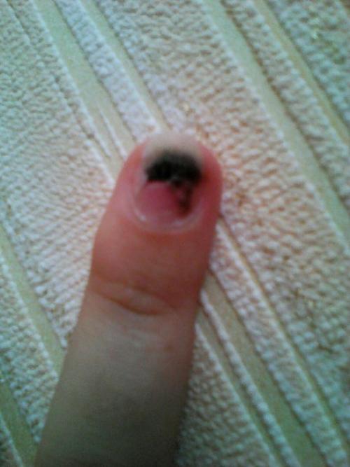 Девчули, можно ли наращивать ноготок? 01