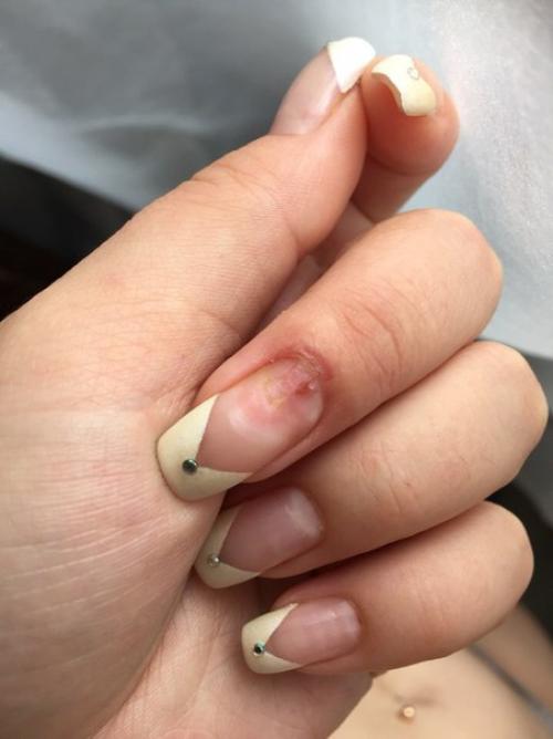 Девочки!  Помогите пожалуйста, что это может быть с ногтем? 01