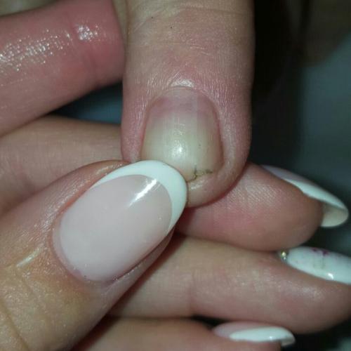 Девочки хелп.  Помогите пожалуйста, как исправить ноготок. 01