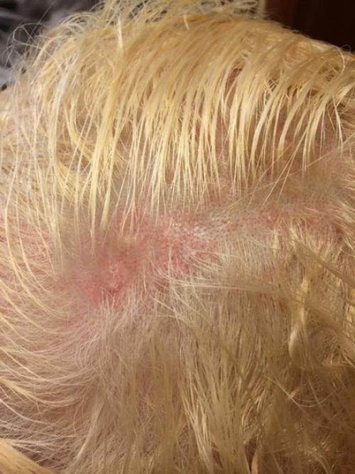 Долго думала, вот и я решила рассказать свою неудачную историю, которая приключилась со мной перед новым годом. 01