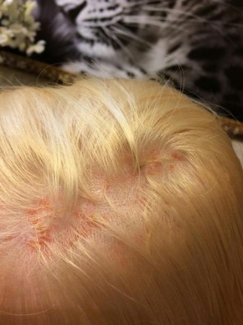 Долго думала, вот и я решила рассказать свою неудачную историю, которая приключилась со мной перед новым годом. 02