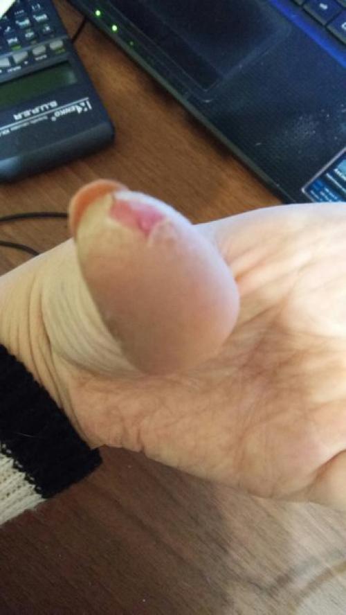 Девочки, после сделанного маникюра появилось на руках вот это. 02