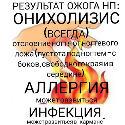 Ожог ногтевой пластины - новое слово в современном маникюре! 07