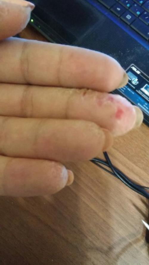 Девочки, после сделанного маникюра появилось на руках вот это. 01