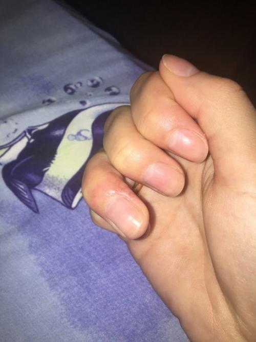 У меня такая проблема. 02 У меня такая проблема. 02