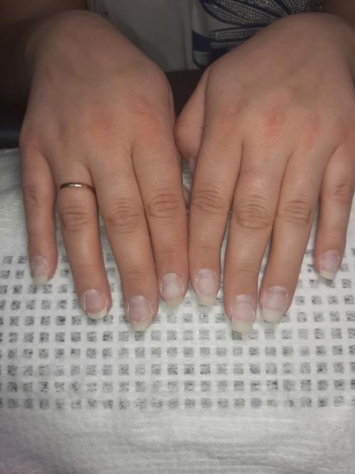 После и до. 02