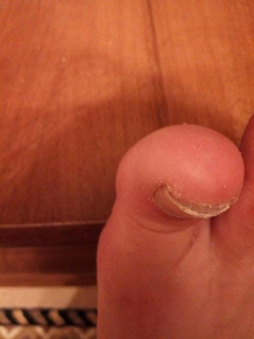 Девочки может кто сталкивался. 01