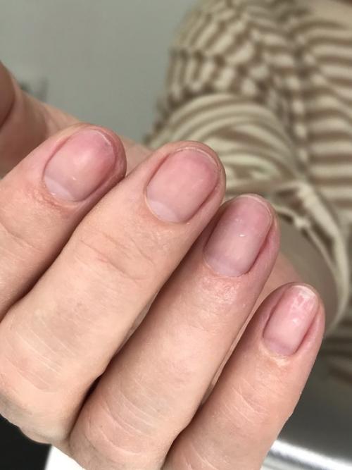 Вы можете поверить в такие превращения? 01