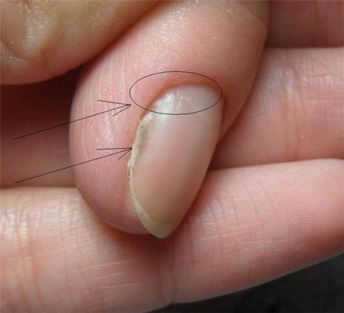 Анонимно.  Админ умоляю пропусти! 01