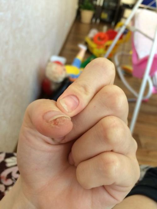 Всем привет девочки особенно аллергики. 01