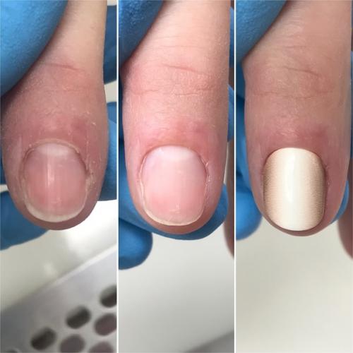 Первый в жизни человека пилочный маникюр с покрытием плёнками. 04