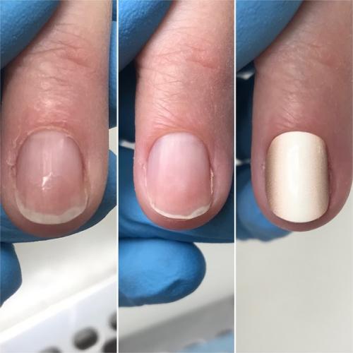 Первый в жизни человека пилочный маникюр с покрытием плёнками. 02