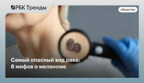 Самый опасный вид рака: 8 мифов о меланоме.

