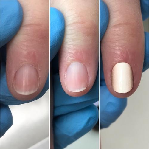 Первый в жизни человека пилочный маникюр с покрытием плёнками. 01