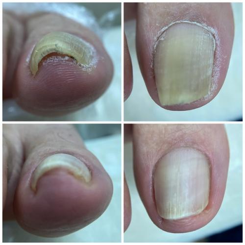 Моя суперсила!   2008-й - эпоха наращивания на типсы. 02