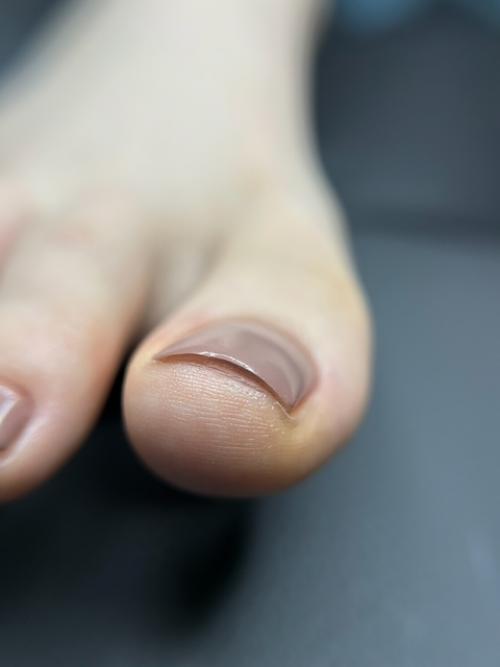 Мои Нет в педикюре, как подолога. 01 Мои Нет в педикюре, как подолога. 01