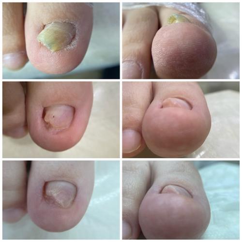 Моя суперсила!   2008-й - эпоха наращивания на типсы. 01