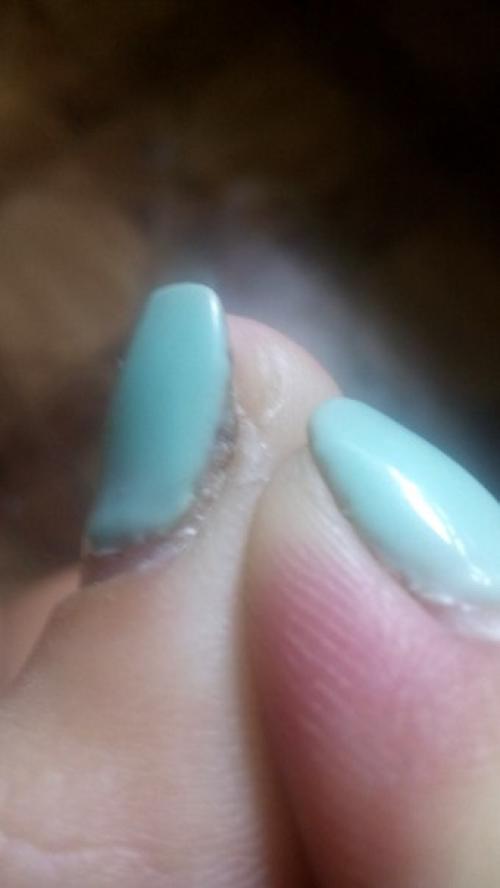 Анон плиз две недели как зделал мткюр перед маникюром сильно ударила палец. 01