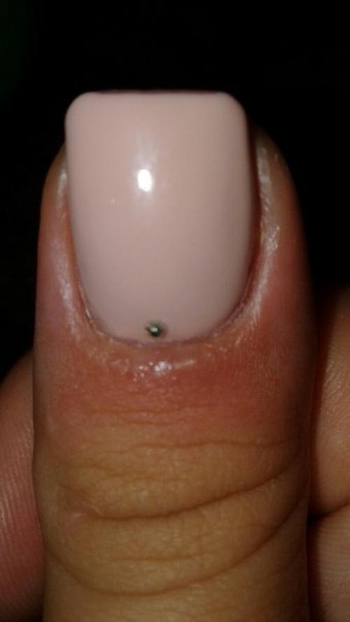 Опубликуйте пожалуйста!  Девочки, чть это может быть? 01