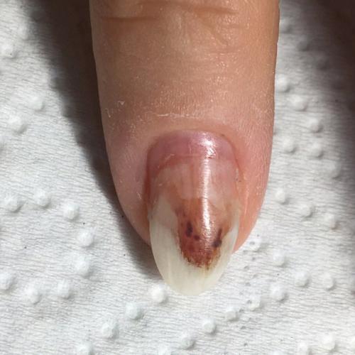 Уважаемые мастера!  Возможно, у кого-то были клиентки с подобной проблемой. 02