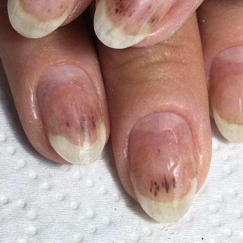 Уважаемые мастера!  Возможно, у кого-то были клиентки с подобной проблемой. 01