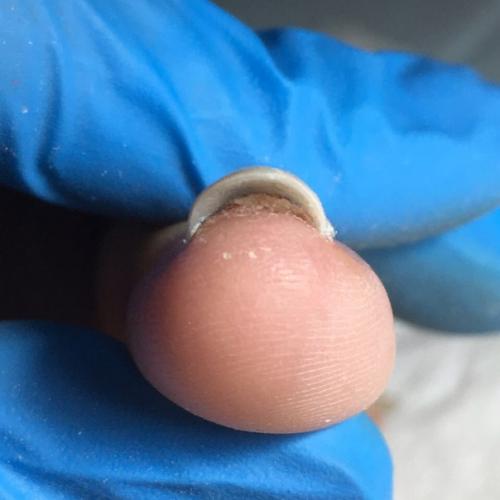 Уважаемые мастера!  Возможно, у кого-то были клиентки с подобной проблемой. 03