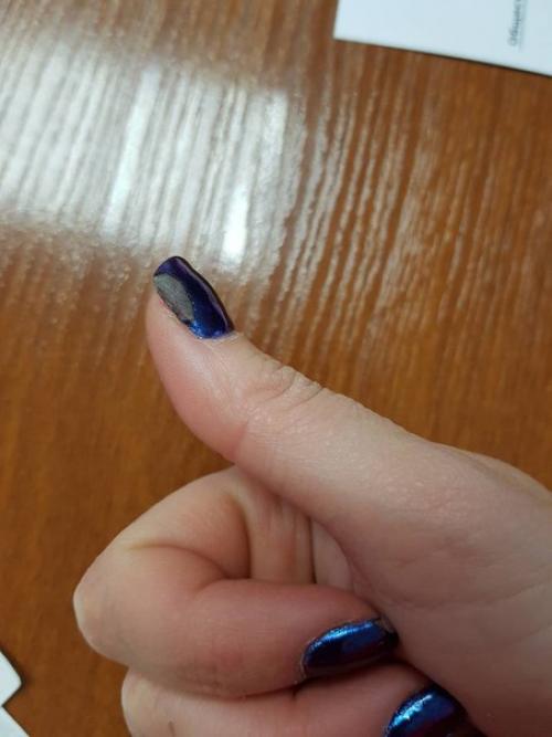 Девочки подскажите!  В чём может быть причина отслойки цвета? 01