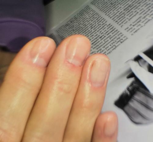 Японский маникюр, на 2 и 3 фото видны пропилы ногтевой пластины, которые уже отросли, от прежнего мастера. 06