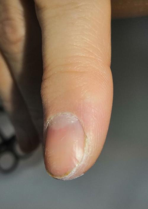 Японский маникюр, на 2 и 3 фото видны пропилы ногтевой пластины, которые уже отросли, от прежнего мастера. 01