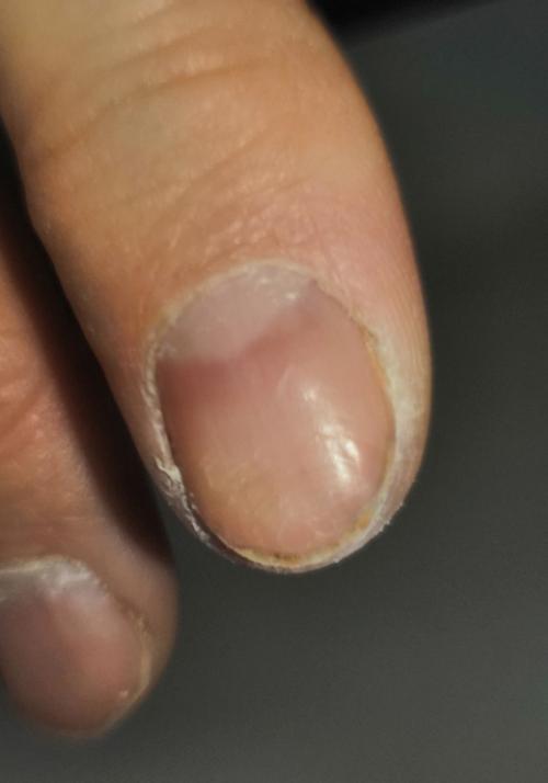 Японский маникюр, на 2 и 3 фото видны пропилы ногтевой пластины, которые уже отросли, от прежнего мастера. 02