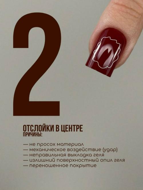 Причины появления отслоек в разных областях ногтя. 01