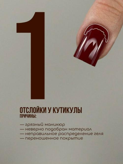 Причины появления отслоек в разных областях ногтя.
