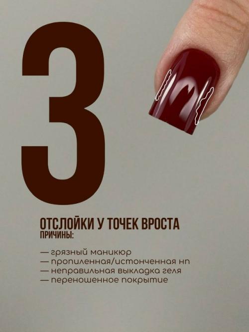 Причины появления отслоек в разных областях ногтя. 02