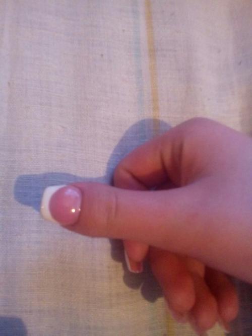 Девочки, у кого был такой сложный пальчик, как подбирали форму! 01