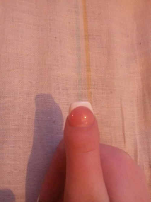 Девочки, у кого был такой сложный пальчик, как подбирали форму! 02