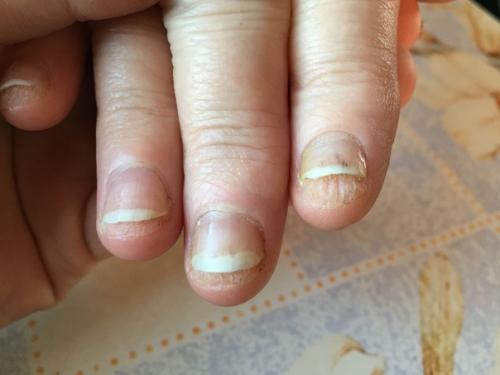 Подскажите пожалуйста, как с этим справиться? 02